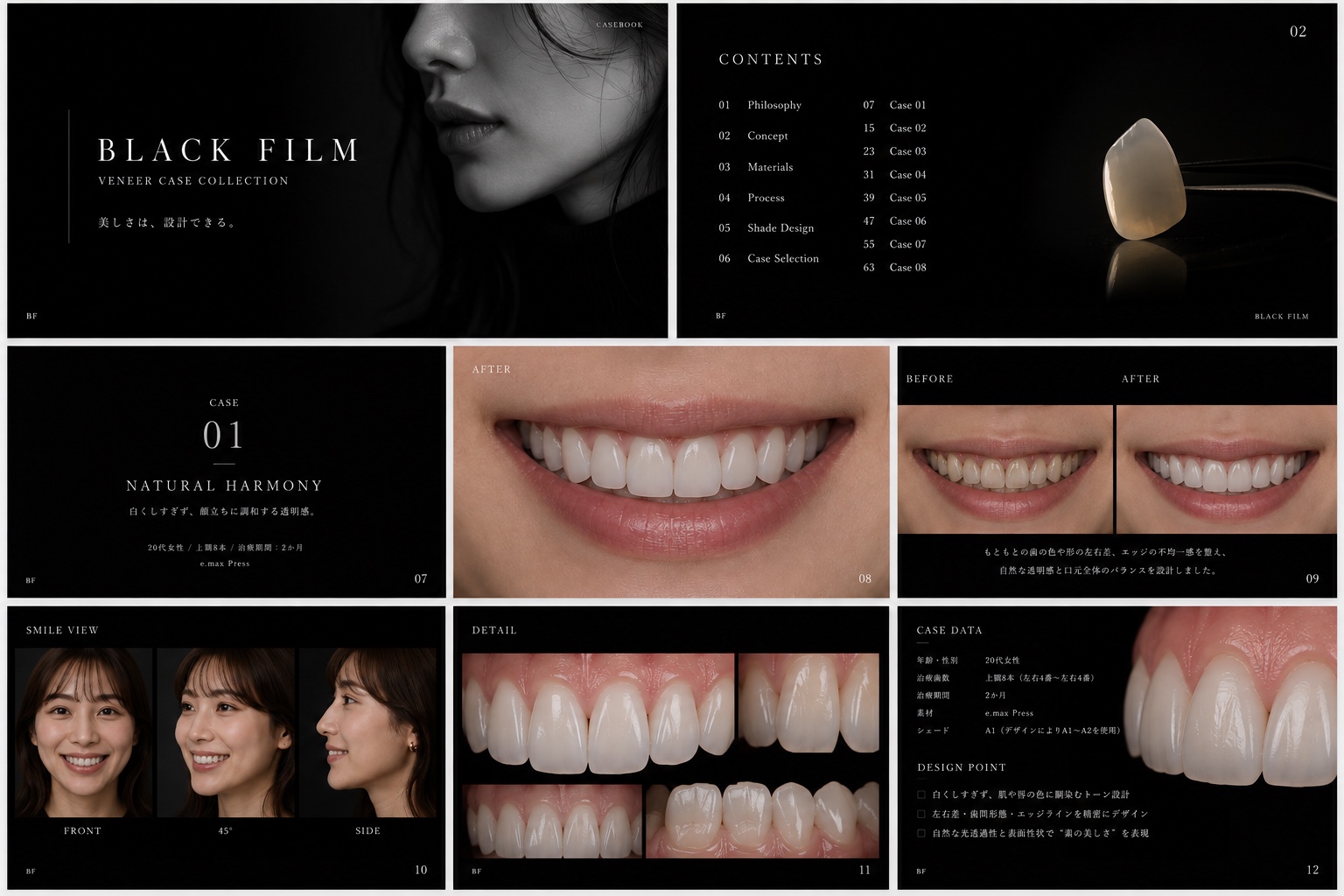 BLACK FILM CASE 01の症例写真集。治療後の笑顔、ビフォーアフター、口元のディテール